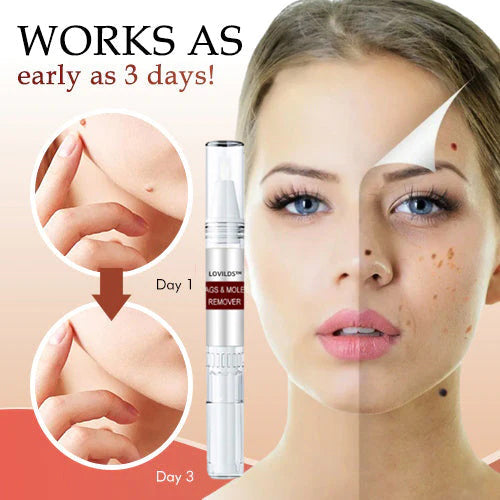 LOVILDS Tags & Moles Remover